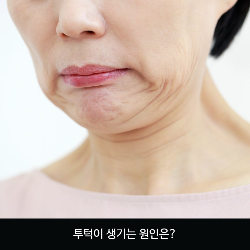 투턱 이미지