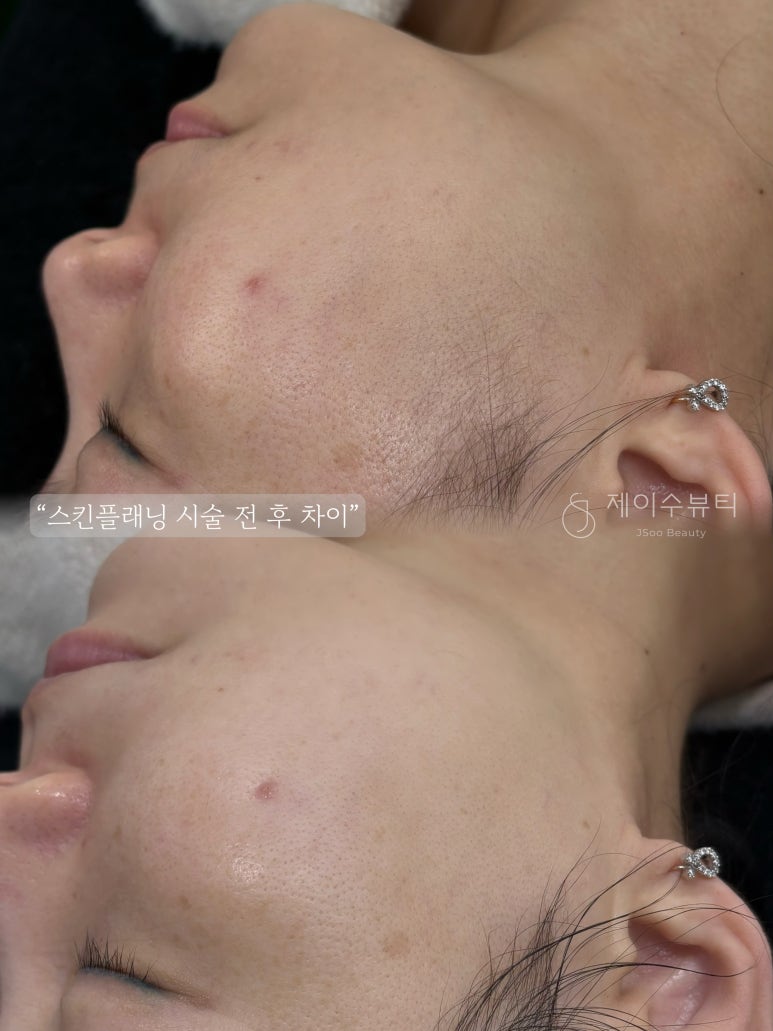 제이수 뷰티 이미지