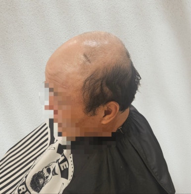 민재가발 이미지