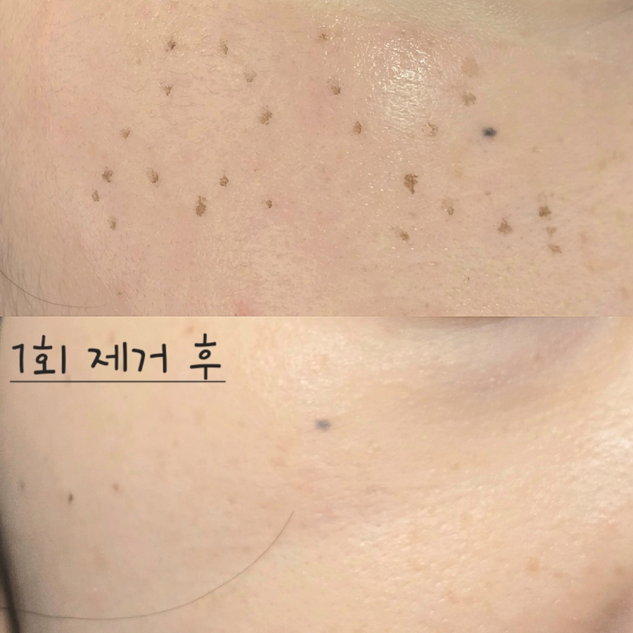 깨순이뷰티 이미지