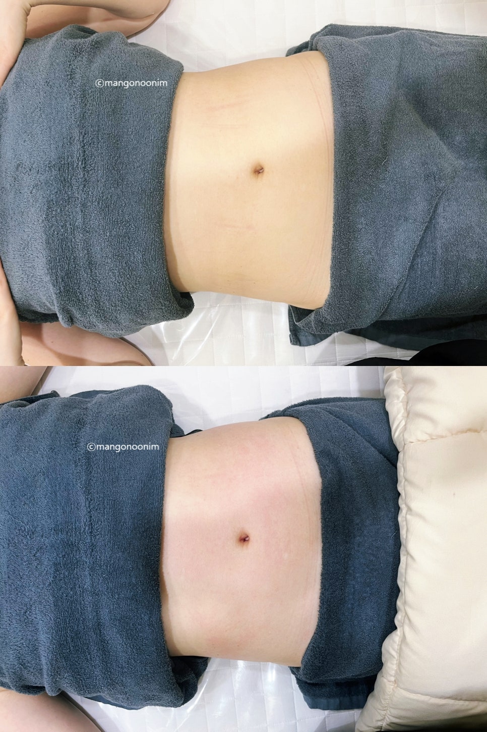 프롬엠 이미지