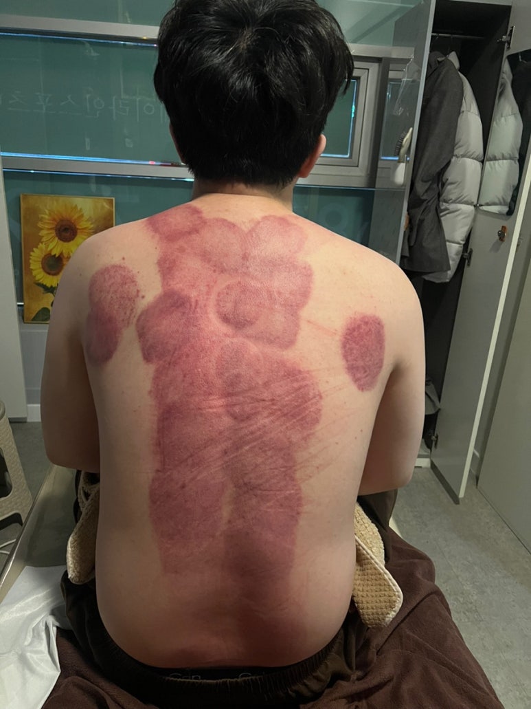 케이스포츠마사지 이미지