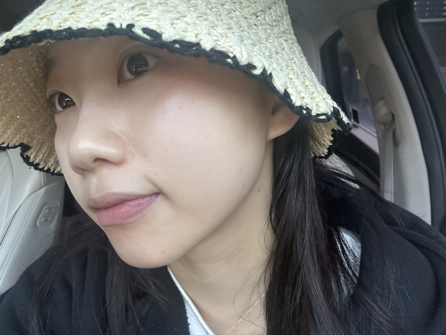 서희 스킨&바디 이미지