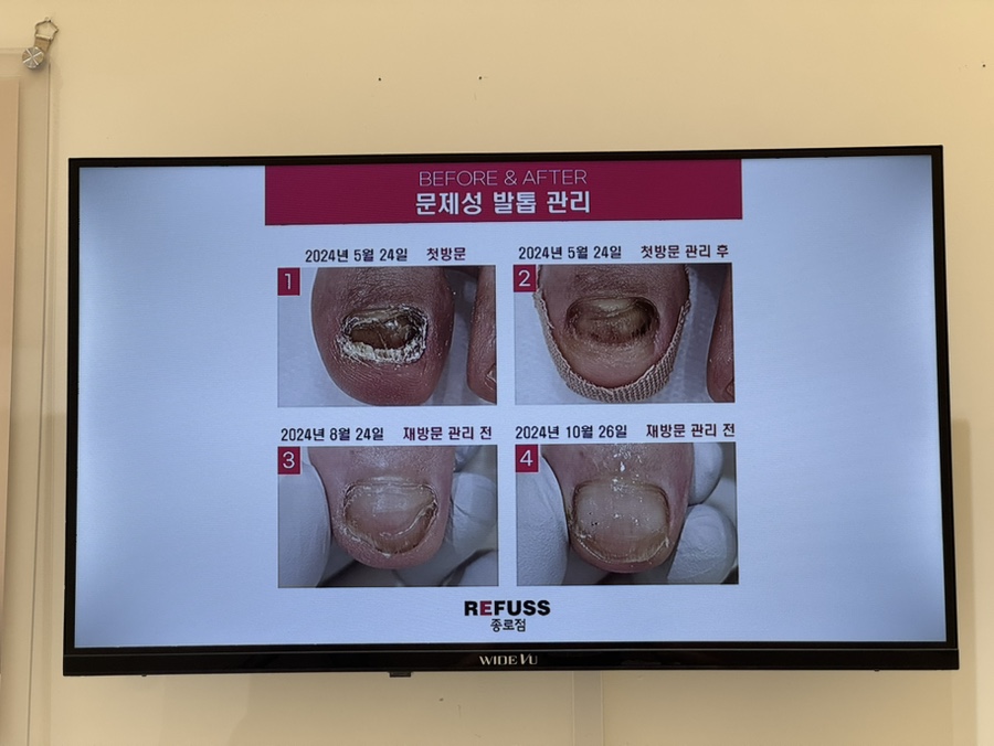 종로발관리 이미지
