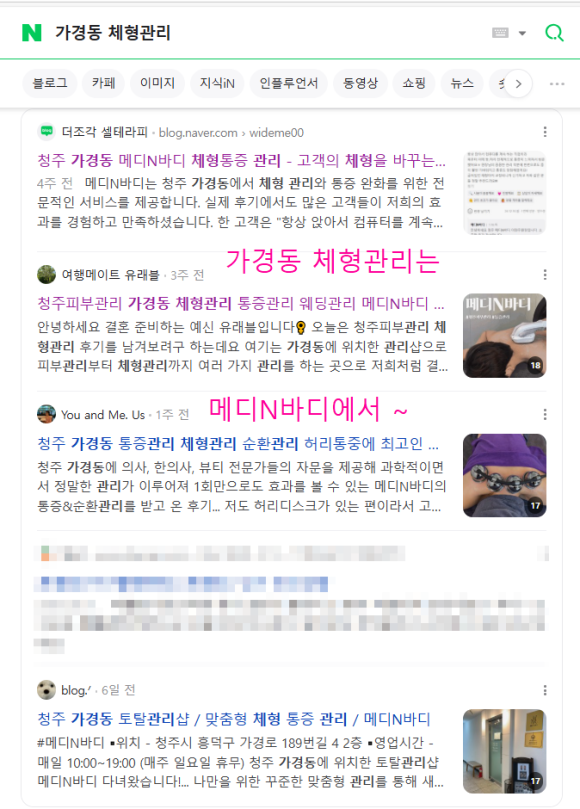 Q체형관리 이미지