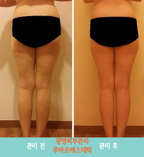 루아르 이미지