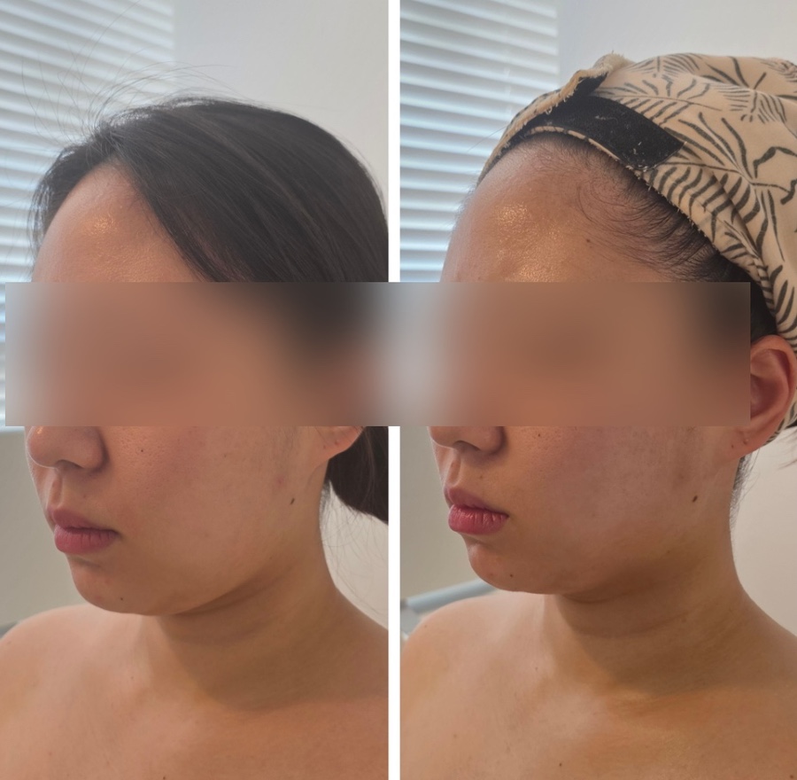 라피움 에스테틱 이미지