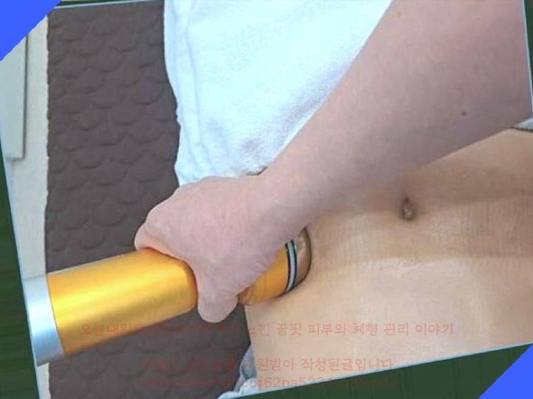 꿀체형관리 이미지