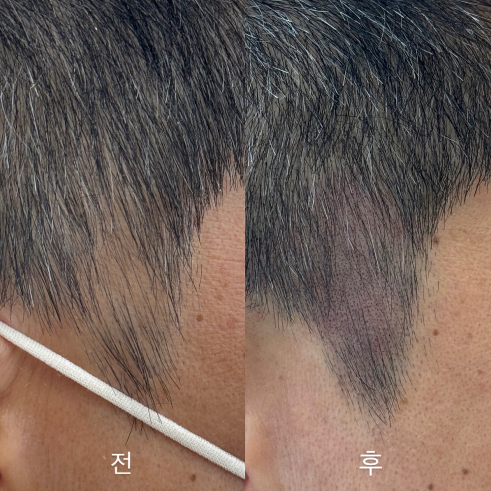 로기SMP 이미지