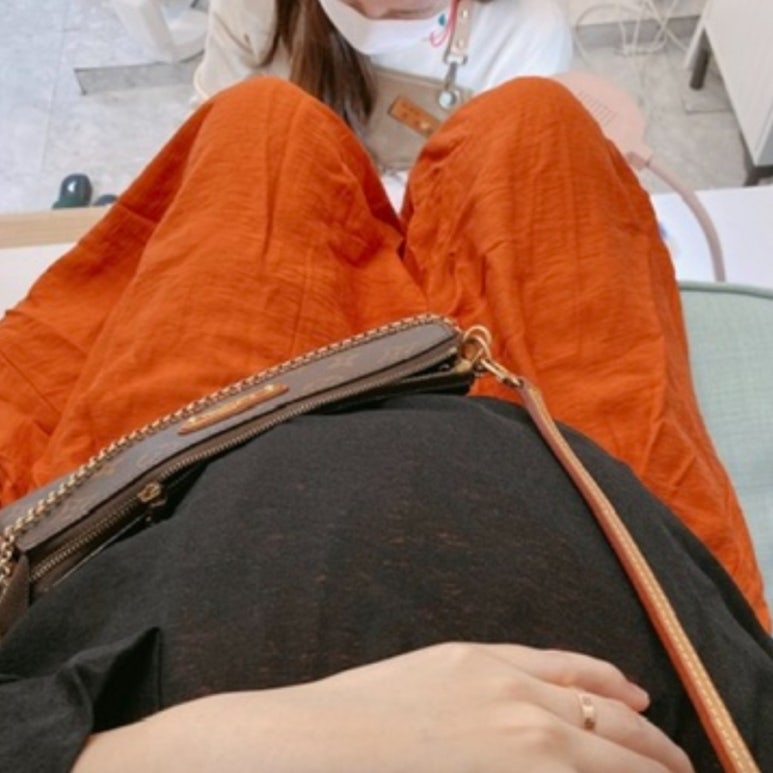허네일 이미지