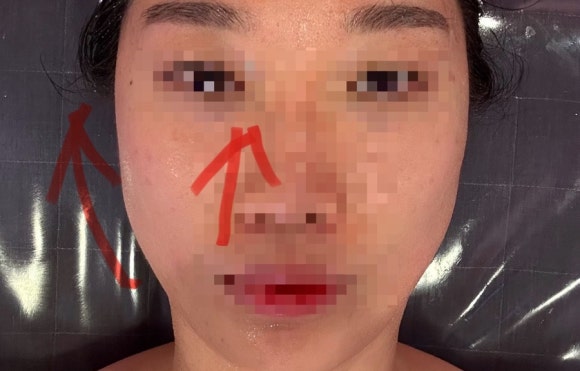 가림피부관리 이미지