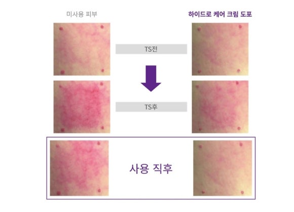 에끌라에스테틱 이미지