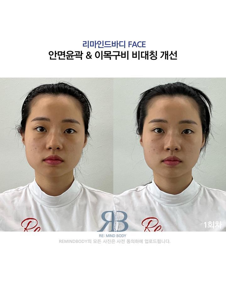 리마인드바디 이미지