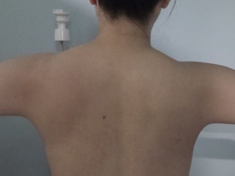 더바른테라피 이미지