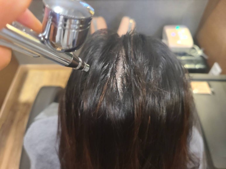 탑스칼프인천점 이미지