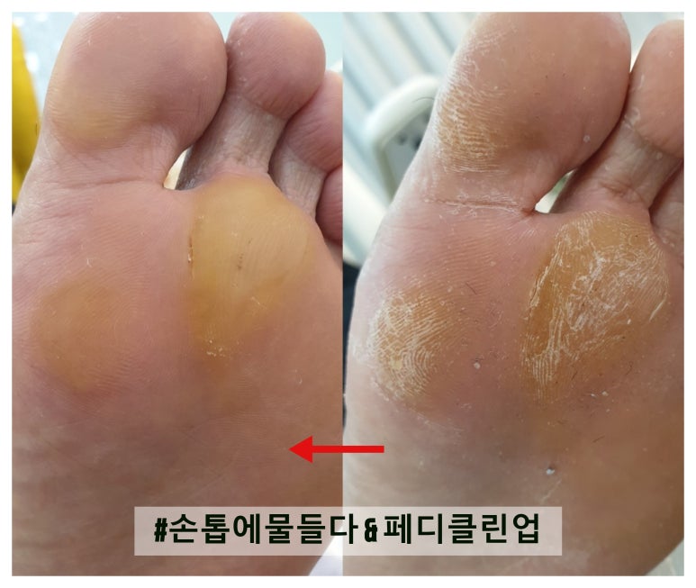 샵 손톱에물들다&페디클린업 이미지
