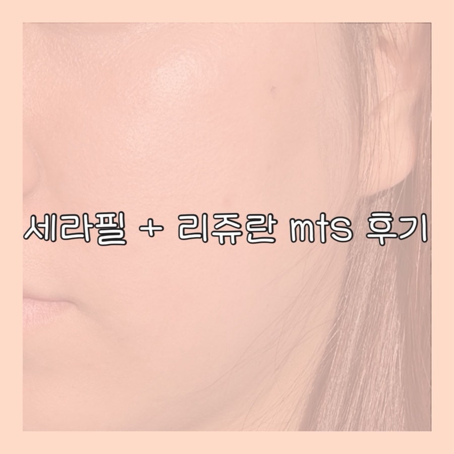 영주스킨케어 이미지