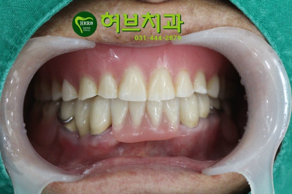 허브치과 이미지