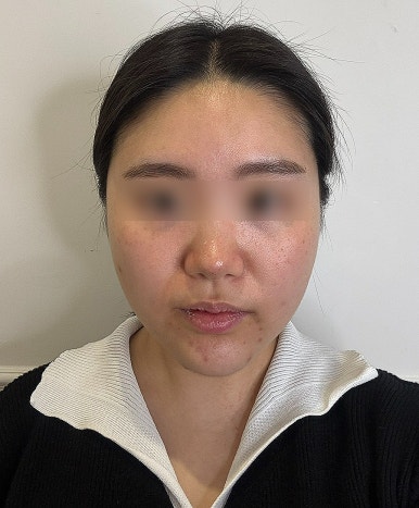 비알부티크 이미지