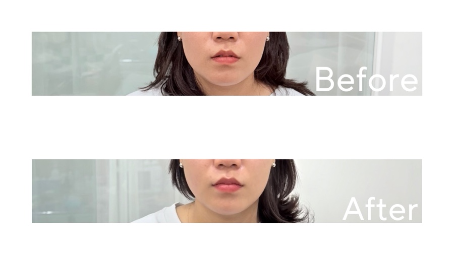 살롱드반 이미지