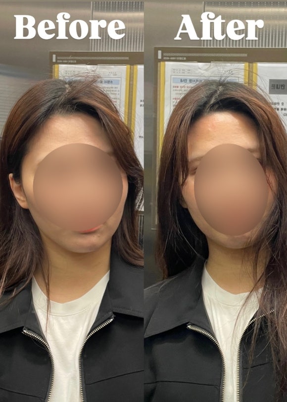 슈가앤라인 이미지