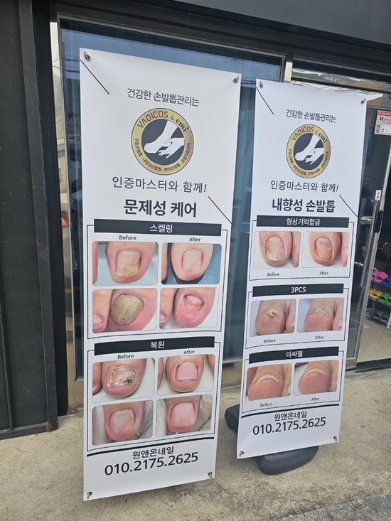 온네일 이미지