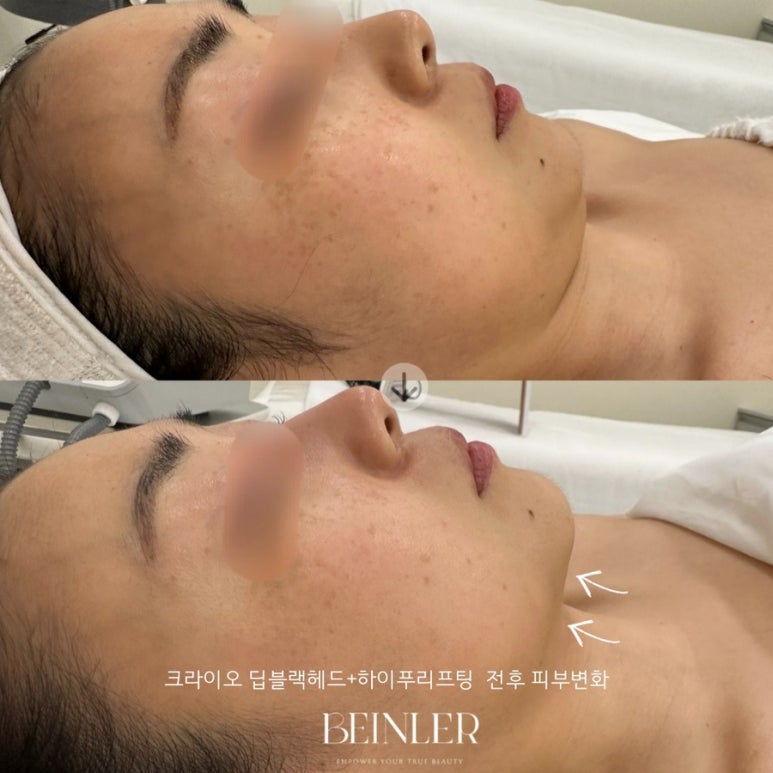 비앙리에 이미지