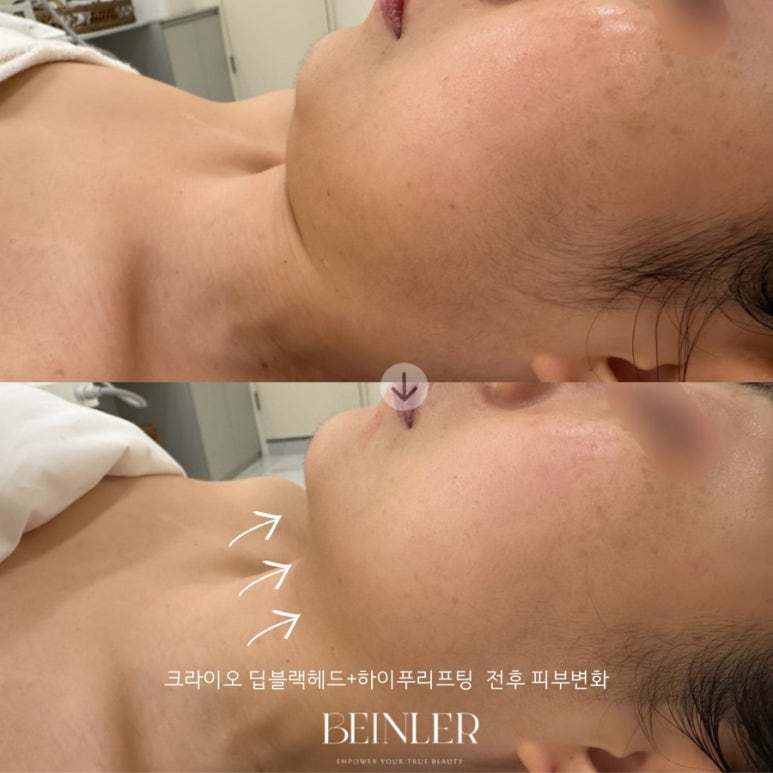 비앙리에 이미지