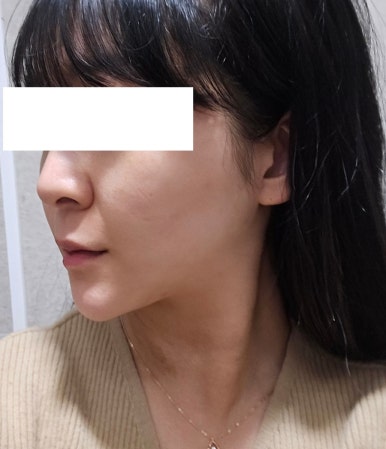 투턱 이미지