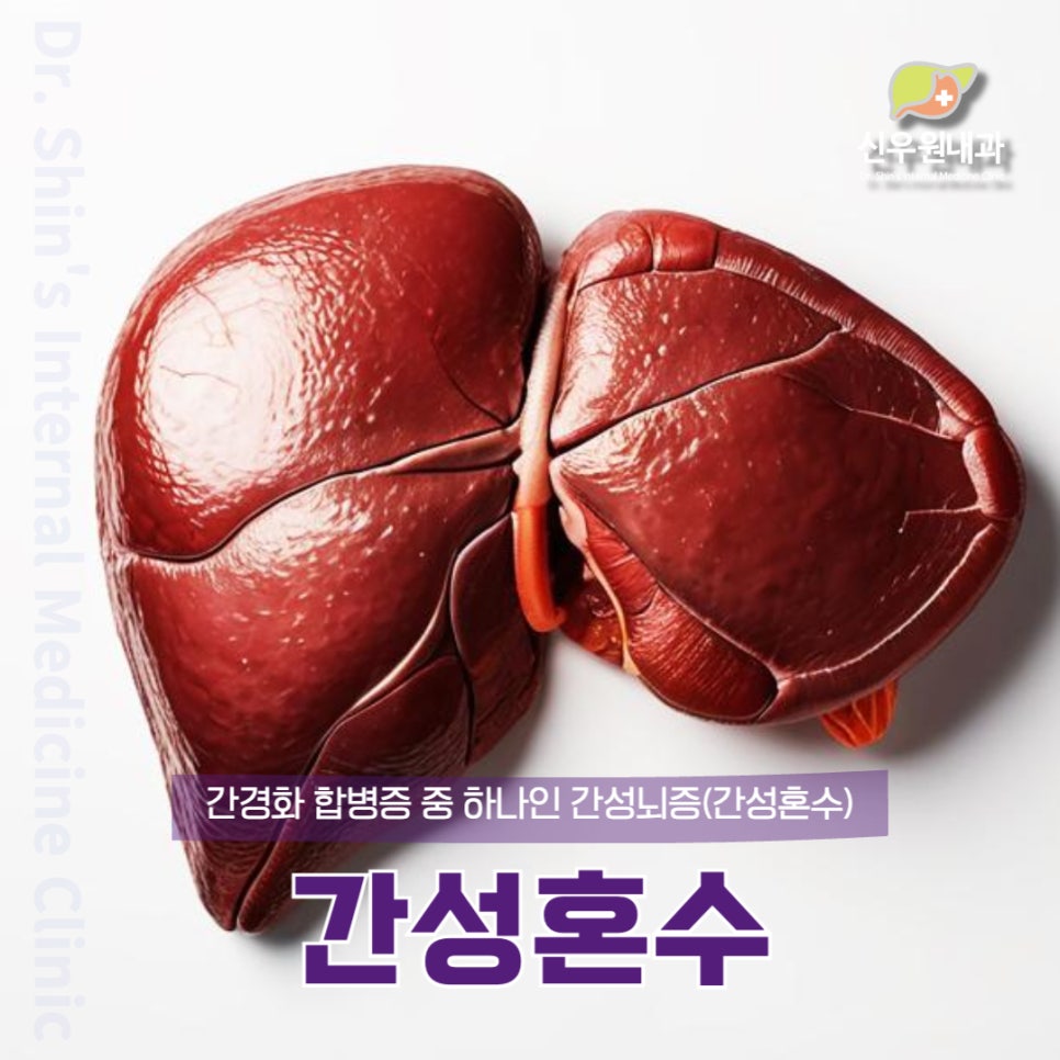 간성에너지 이미지