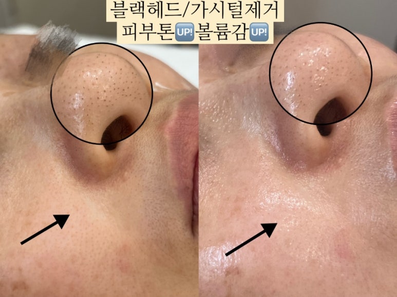 자신감 피부관리샵 이미지