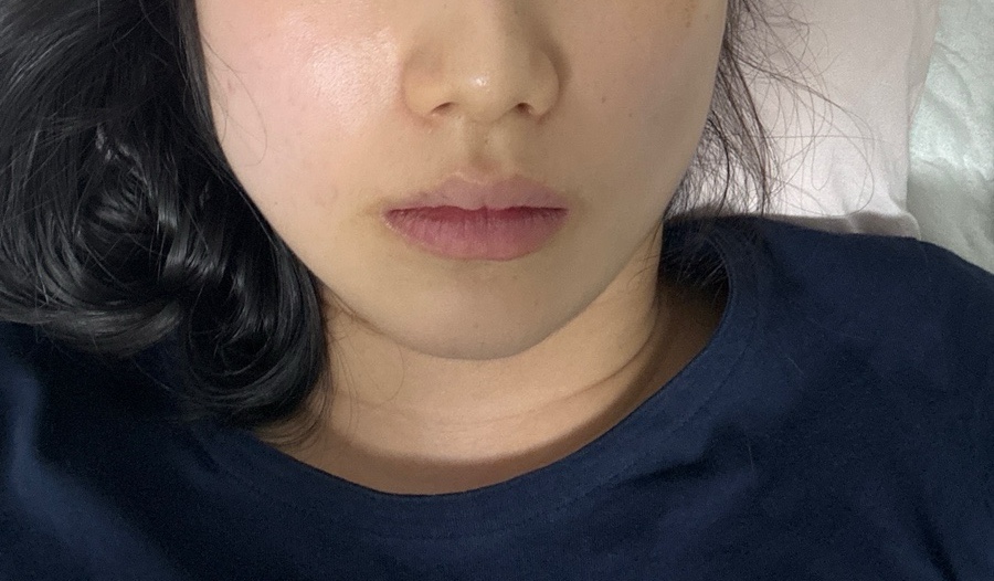 마로니에치과 이미지