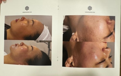 비움채뷰티아비스 이미지
