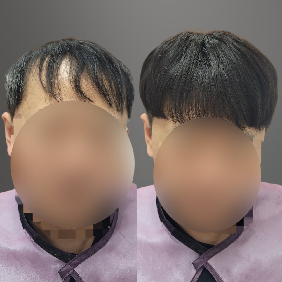 리썸위그 이미지