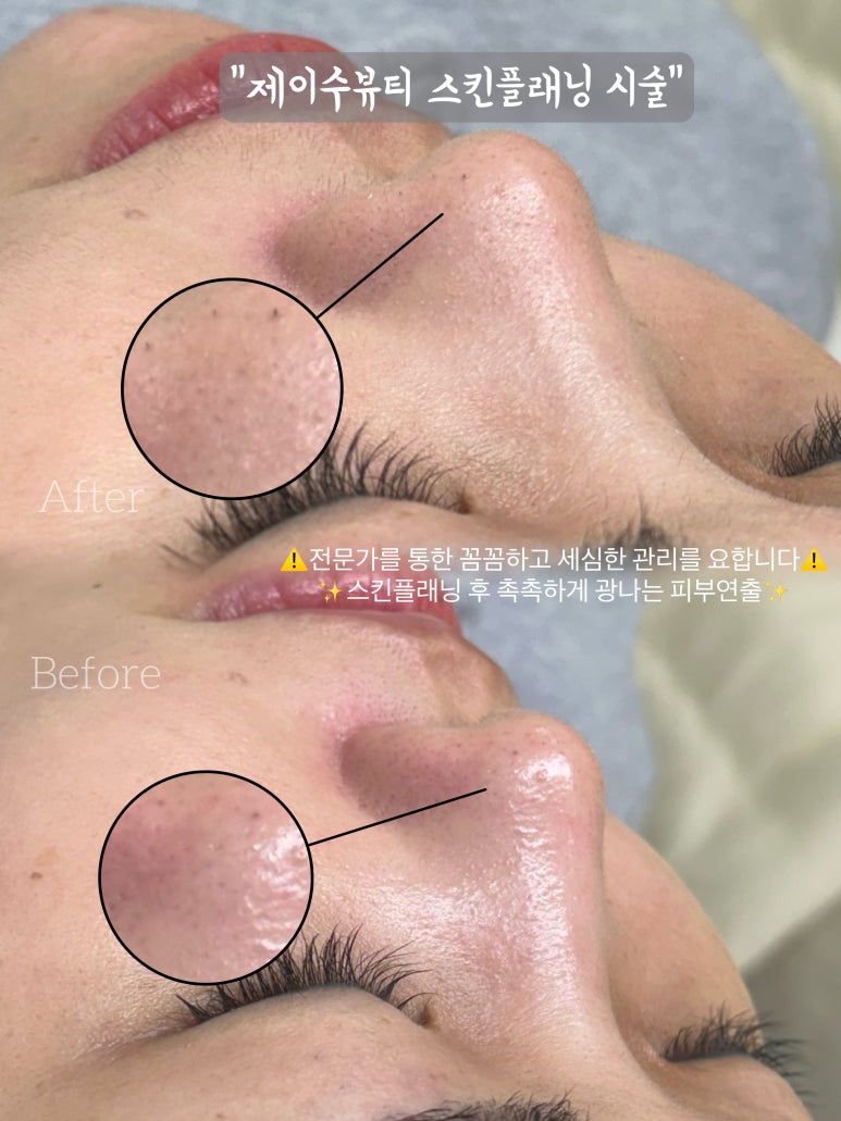 제이수 뷰티 이미지
