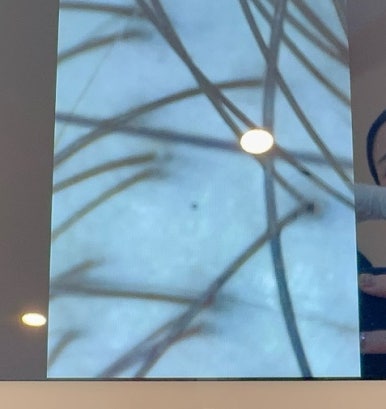 리스칼프결 이미지