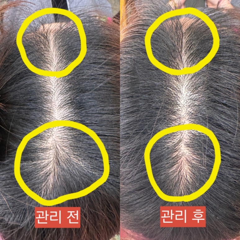 혜라헤어 이미지