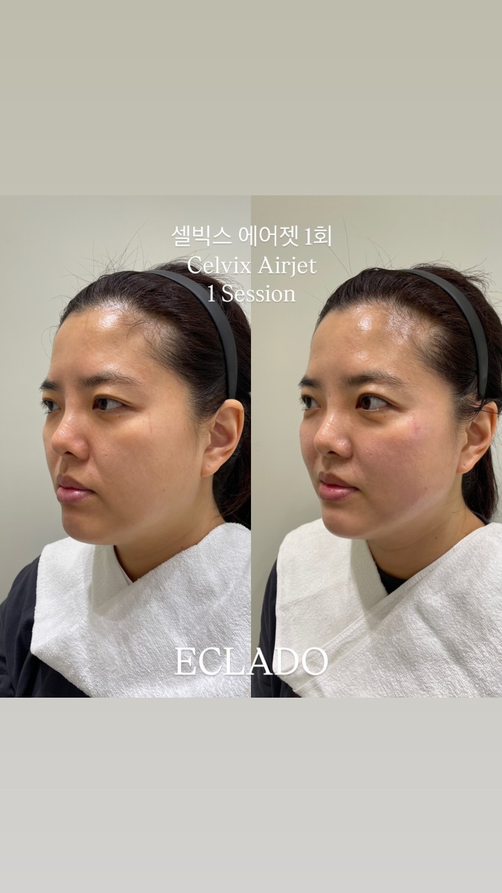 빅스페이스 이미지