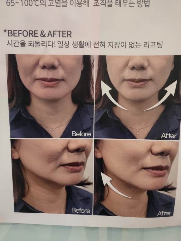 윤스킨앤바디 이미지