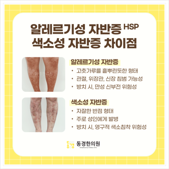 동경반점 이미지