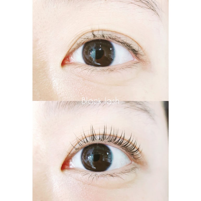 블랙래쉬 이미지