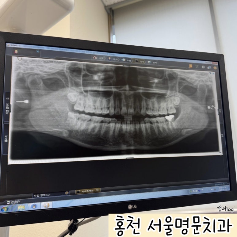 서울명문치과 이미지