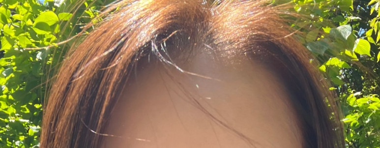 어트랙 이미지