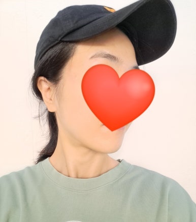 서희 스킨&바디 이미지