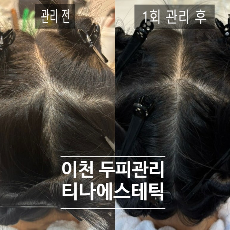 티나 에스테틱 이미지