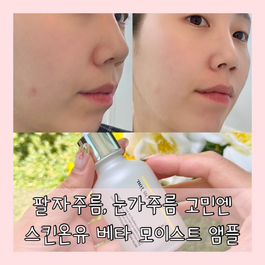 스킨온유 이미지