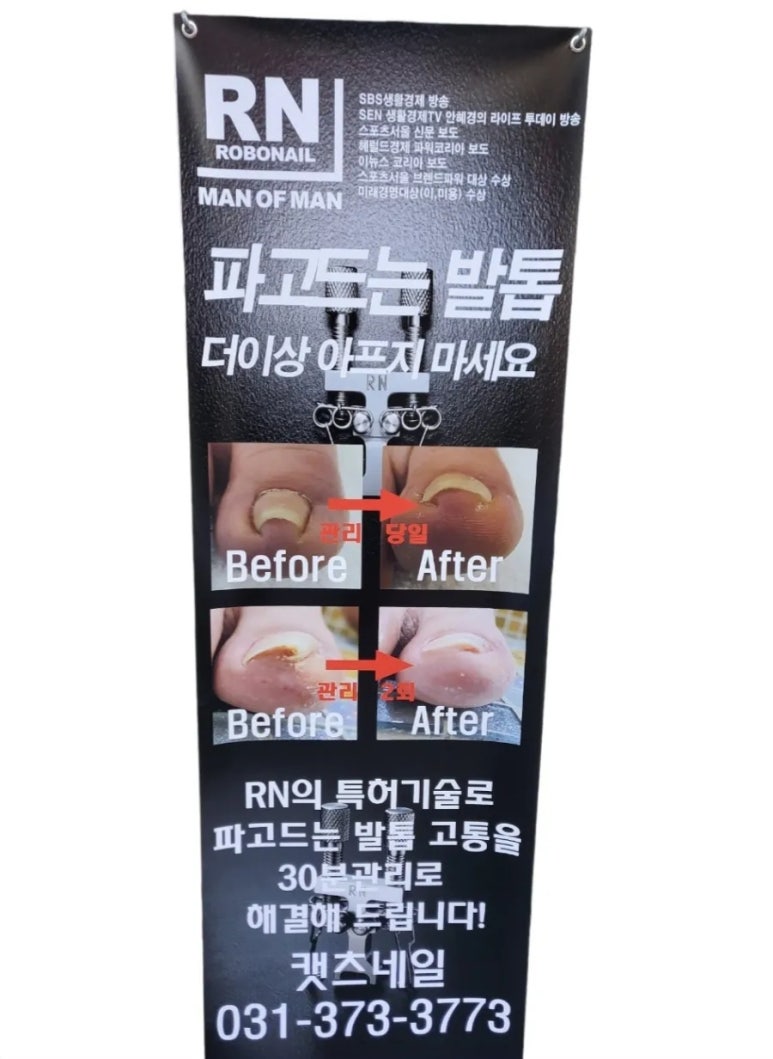 금붕어네일 이미지