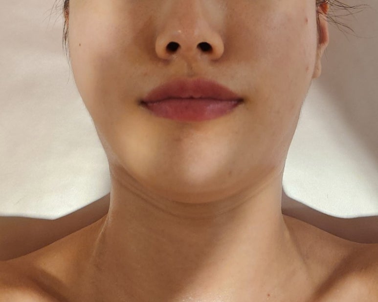 골드 스킨앤바디 이미지