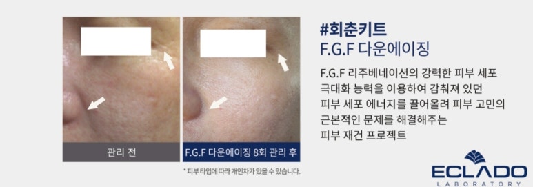 에끌라두 이미지