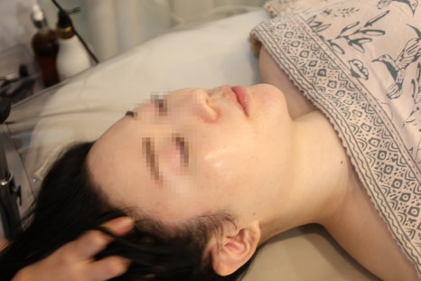 전에스테틱 이미지